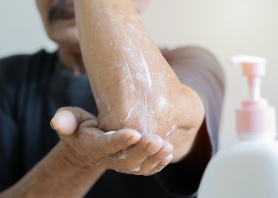 Liebe zum Duschen/kratzige Haut