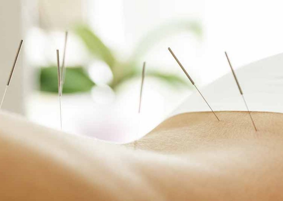 Akupunktur - Kann chinesische Medizin wirklich helfen? Akupunktur - Kann chinesische Medizin wirklich helfen?