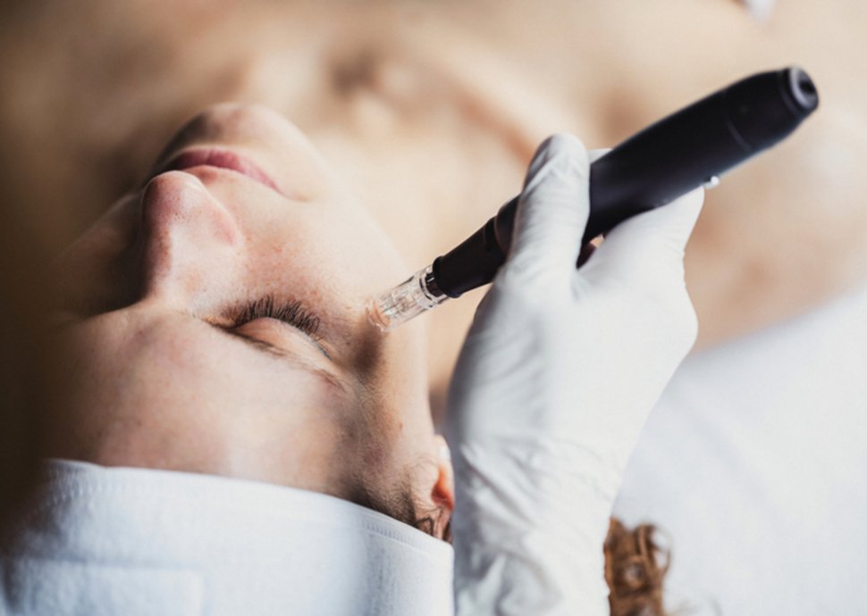 Falten mildern: die überraschend einfachen Wege